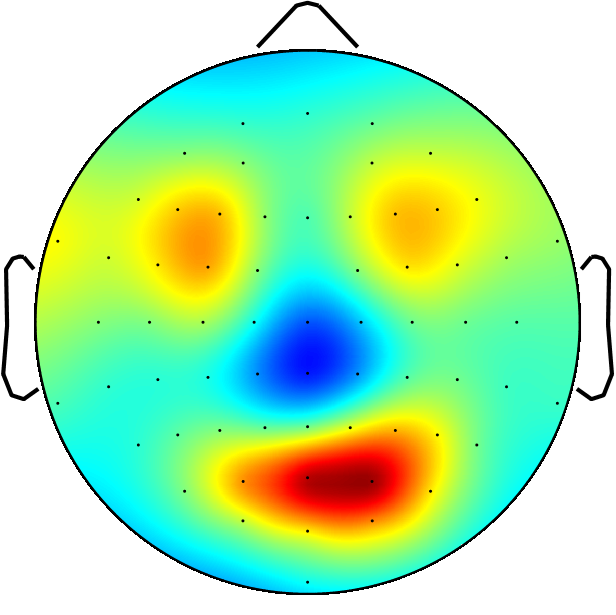 Topography map of the head