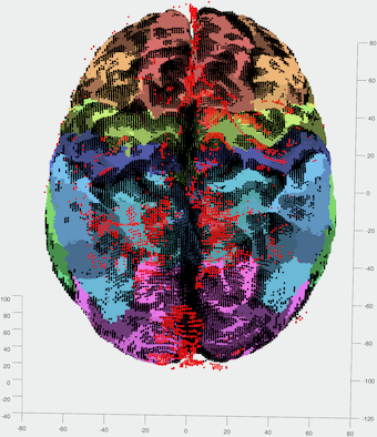 Brain topography